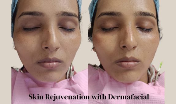 WhatsApp Image 2025-06-19 at 3.18.46 PM WhatsApp Image 2025-06-19 at 3.18.46 PM